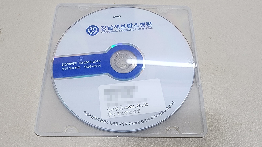 후종인대골화증 수술 10주년 촬영 CD